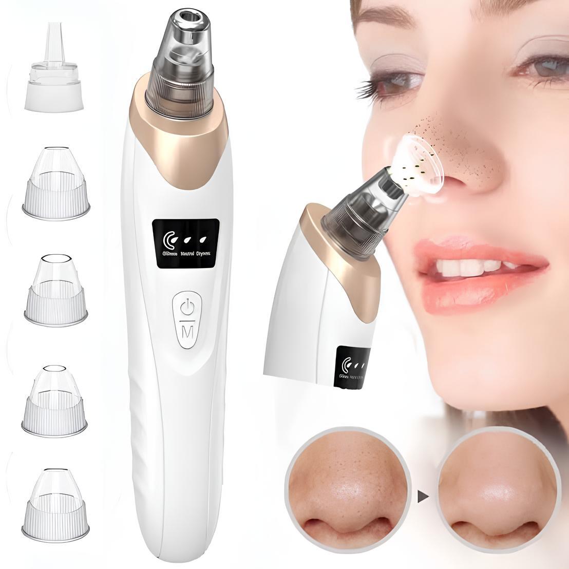 Electric blackhead Remover
